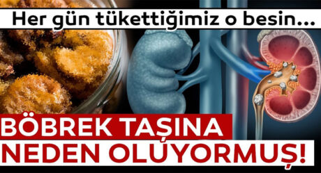 Böbrek taşına neden olan besinler!